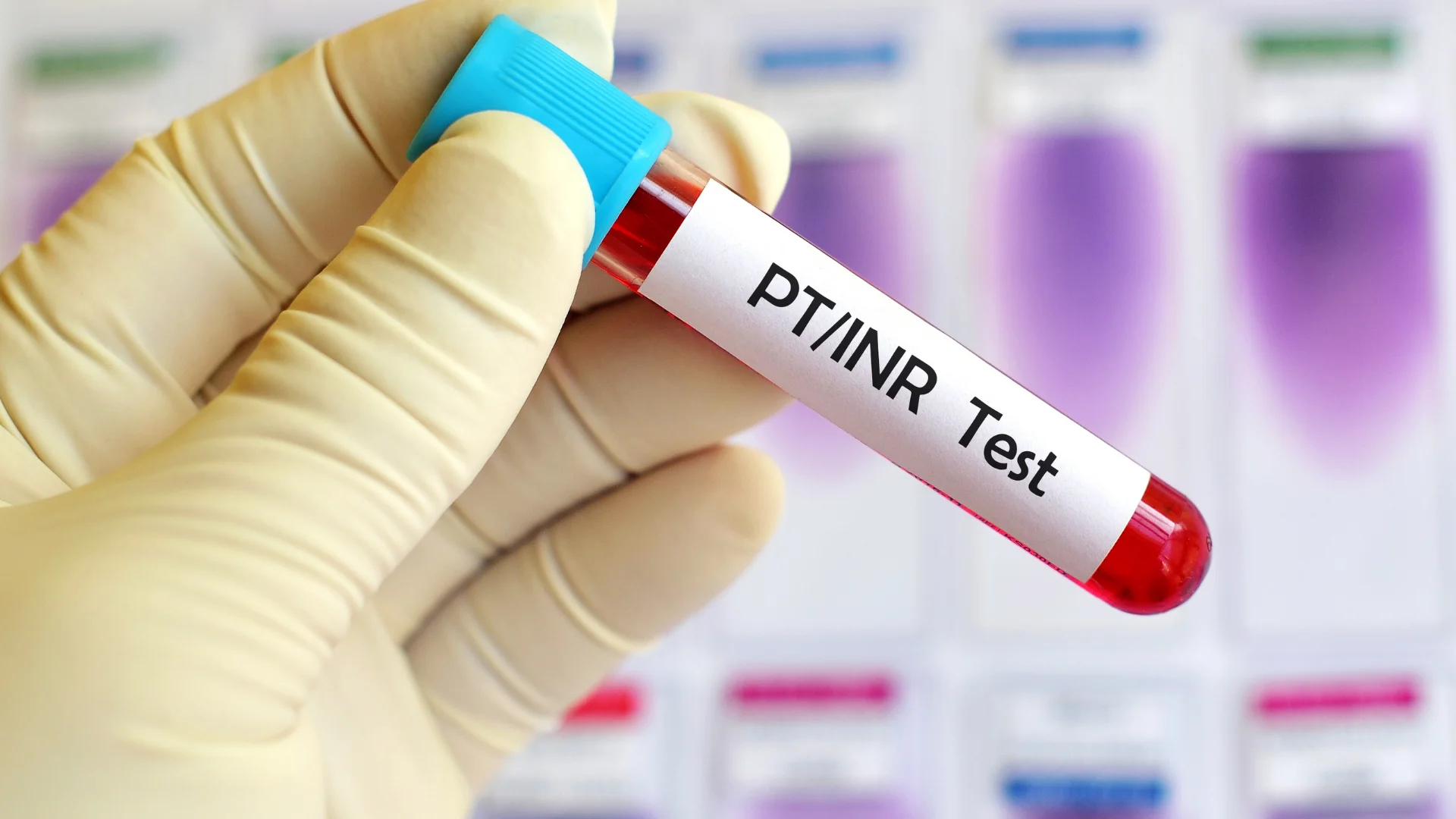PT/INR Test